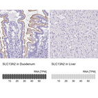 Anti-SLC13A2 Antibody