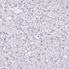 Anti-SLC13A2 Antibody