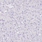 Immunohistochemical staining of human liver shows low expression as expected.