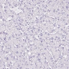 Immunohistochemical staining of human liver shows low expression as expected.