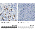 Anti-SLC12A1 Antibody
