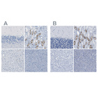 Immunohistochemical staining of human cerebellum, kidney, liver and pancreas using Anti-SLC12A1 antibody HPA014967 (A) shows similar protein distribution across tissues to independent antibody HPA018107 (B).