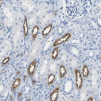 Immunohistochemical staining of human kidney shows strong membranous positivity in cells in tubules.