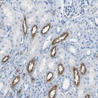 Immunohistochemical staining of human kidney shows strong membranous positivity in cells in tubules.