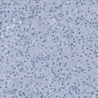 Immunohistochemical staining of human pancreas shows no positivity in exocrine glandular cells as expected.