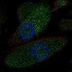 Immunofluorescent staining of human cell line RPTEC TERT1 shows localization to nucleus & vesicles.