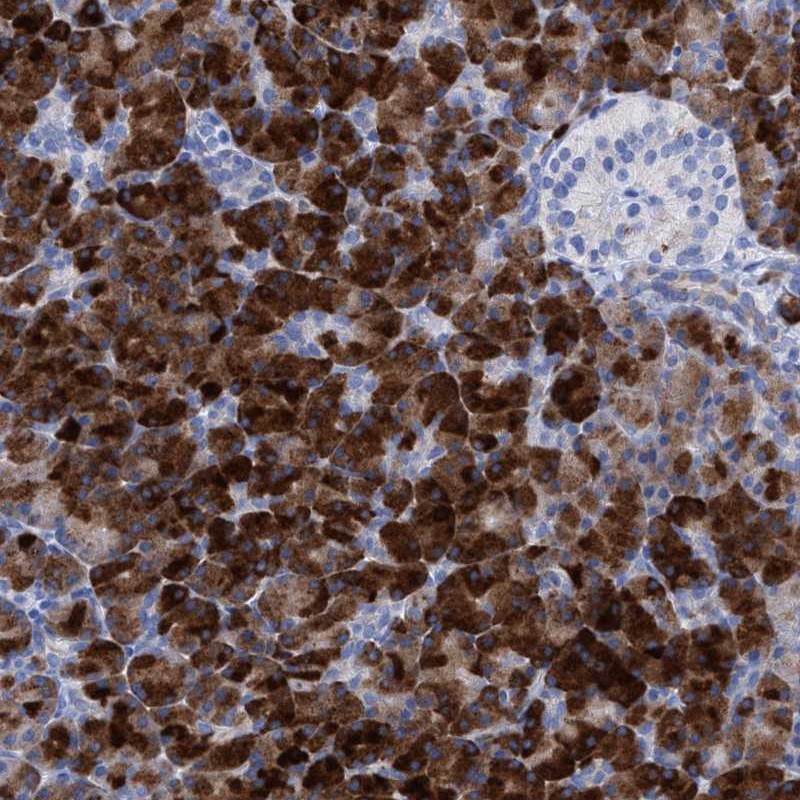 Anti-PLPPR1 Antibody