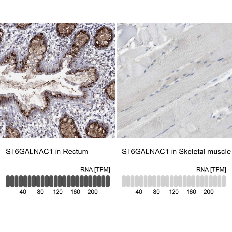 Anti-ST6GALNAC1 Antibody