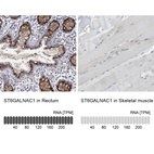 Anti-ST6GALNAC1 Antibody