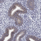 Immunohistochemical staining of human endometrium shows strong positivity in Golgi apparatus in glandular cells.