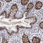 Immunohistochemical staining of human rectum shows strong positivity in Golgi apparatus in glandular cells.