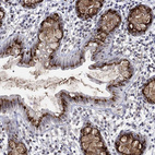 Anti-ST6GALNAC1 Antibody