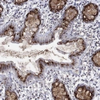 Immunohistochemical staining of human rectum shows strong positivity in Golgi apparatus in glandular cells.