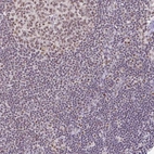 Immunohistochemical staining of human Lymph node shows moderate nuclear positivity in germinal and non germinal center cells.