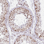 Immunohistochemical staining of human Testis shows moderate nuclear positivity in cells in seminiferous ducts and Leydig cells.