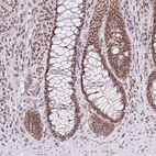 Immunohistochemical staining of human Rectum shows moderate nuclear positivity in glandular cells.