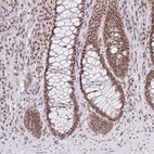 Immunohistochemical staining of human Rectum shows moderate nuclear positivity in glandular cells.