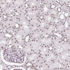Immunohistochemical staining of human Kidney shows weak nuclear positivity in cells in tubules.