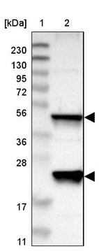 Lane 1: Marker [kDa] 230, 130, 95, 72, 56, 36, 28, 17, 11_br/_Lane 2: Human cell line RT-4