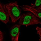 Immunofluorescent staining of human cell line U-251 MG shows localization to nucleoplasm.