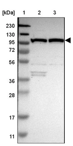 Lane 1: Marker [kDa] 230, 130, 95, 72, 56, 36, 28, 17, 11_br/_Lane 2: Human cell line RT-4_br/_Lane 3: Human cell line U-251MG sp