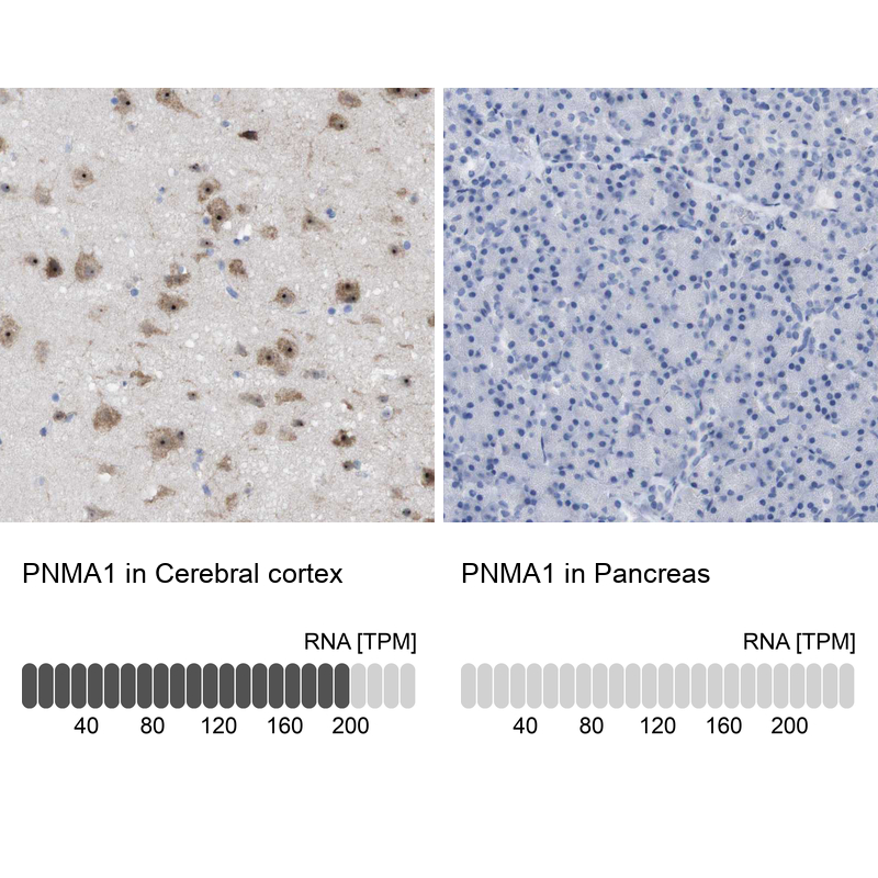Anti-PNMA1 Antibody