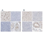 Immunohistochemical staining of human cerebral cortex, liver, pancreas and testis using Anti-PNMA1 antibody HPA015007 (A) shows similar protein distribution across tissues to independent antibody HPA003817 (B).