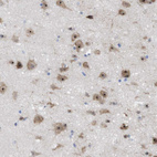 Immunohistochemical staining of human cerebral cortex shows strong nuclear positivity in neurons.