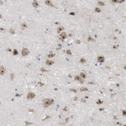 Immunohistochemical staining of human cerebral cortex shows strong nuclear positivity in neurons.