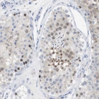 Immunohistochemical staining of human testis shows weak nuclear positivity in cells in seminiferous ducts.
