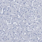 Immunohistochemical staining of human liver shows no positivity in hepatocytes as expected.