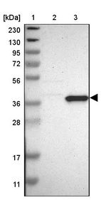 Lane 1: Marker [kDa] 230, 130, 95, 72, 56, 36, 28, 17, 11_br/_Lane 2: Human cell line RT-4_br/_Lane 3: Human cell line U-251MG sp