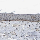 Immunohistochemical staining of human skin shows moderate cytoplasmic positivity in basal squamous epithelial cells.