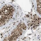 Immunohistochemical staining of human testis shows strong nuclear positivity in cells in seminiferous ducts and Leydig cells.