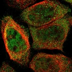 Immunofluorescent staining of human cell line A-431 shows localization to nucleoplasm & cytosol.