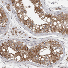 Immunohistochemical staining of human testis shows moderate membranous and cytoplasmic positivity in cells in seminiferous ducts.