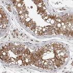 Immunohistochemical staining of human testis shows moderate membranous and cytoplasmic positivity in cells in seminiferous ducts.