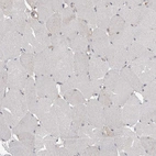 Immunohistochemical staining of human skeletal muscle shows no positivity in myocytes as expected.