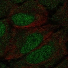 Anti-DCLK1 Antibody