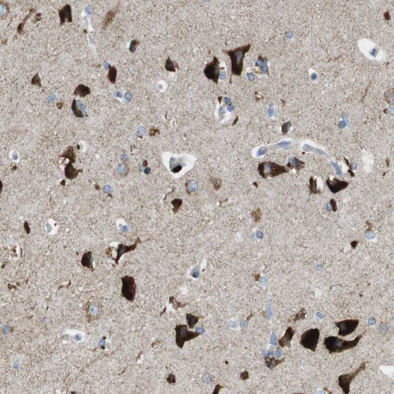 Anti-TMEM234 Antibody