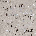 Anti-TMEM234 Antibody