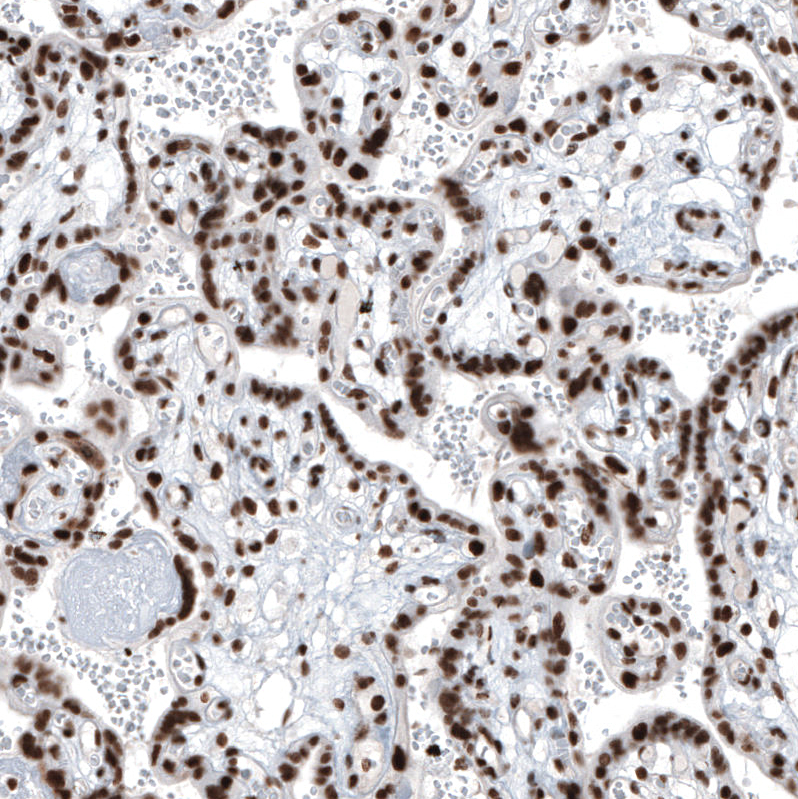 Anti-BRD4 Antibody