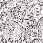 Anti-BRD4 Antibody