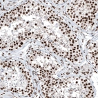 Immunohistochemical staining of human testis shows moderate to strong nuclear positivity in cells in seminiferous ducts.