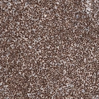 Immunohistochemical staining of human tonsil shows moderate to strong nuclear positivity in non-germinal center cells.