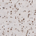 Immunohistochemical staining of human cerebral cortex shows moderate to strong nuclear positivity in neurons.