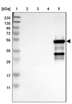 Lane 1: Marker [kDa] 230, 130, 95, 72, 56, 36, 28, 17, 11_br/_Lane 2: Human cell line RT-4_br/_Lane 3: Human cell line U-251MG sp_br/_Lane 4: Human plasma (IgG/HSA depleted)_br/_Lane 5: Human liver tissue