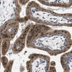 Anti-CREB3L2 Antibody