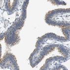 Immunohistochemical staining of human Fallopian tube shows moderate cytoplasmic positivity in glandular cells.