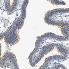 Immunohistochemical staining of human Fallopian tube shows moderate cytoplasmic positivity in glandular cells.